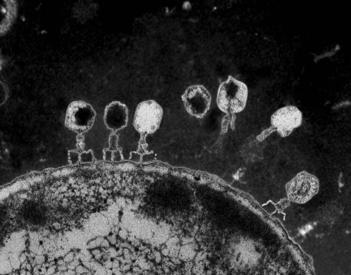 Bacteriophages attached to a bacterial cell